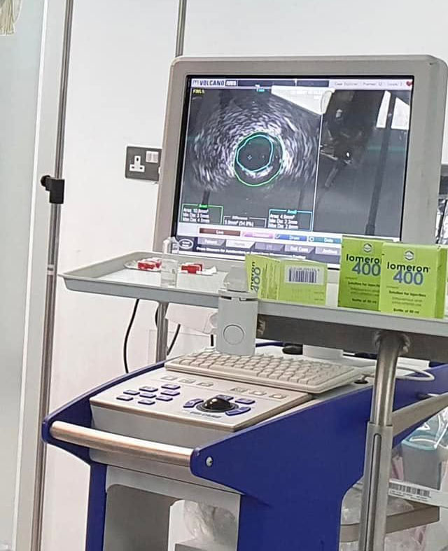 IVUS